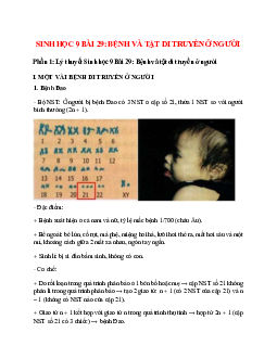 Lý thuyết Sinh học 9 Bài 29 (mới 2023 + 18 câu trắc nghiệm): Bệnh và tật di truyền ở người