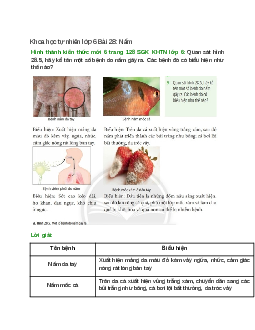  Quan sát hình 28.5, hãy kể tên một số bệnh do nấm gây ra