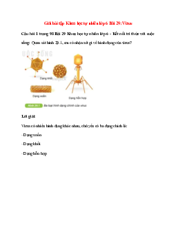 Quan sát hình 29.1, em có nhận xét gì về hình dạng của virus