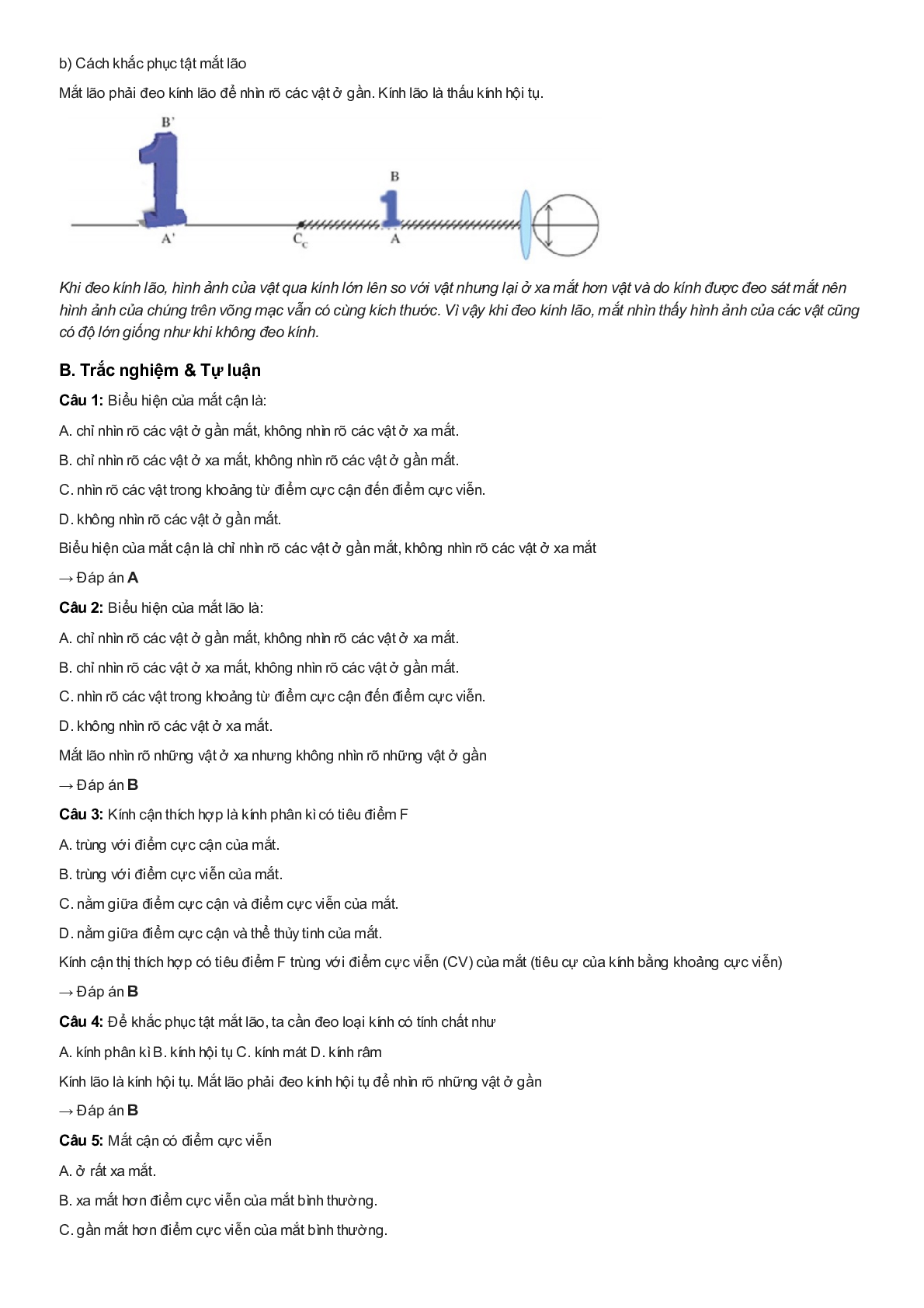 Chuyên đề Vật lý 9: Mắt cận và mắt lão (trang 2)