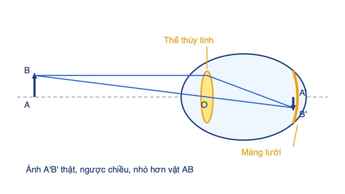 Sơ đồ tạo ảnh của vật AB trên màng lưới qua thể thủy tinh, ảnh A'B' ngược chiều